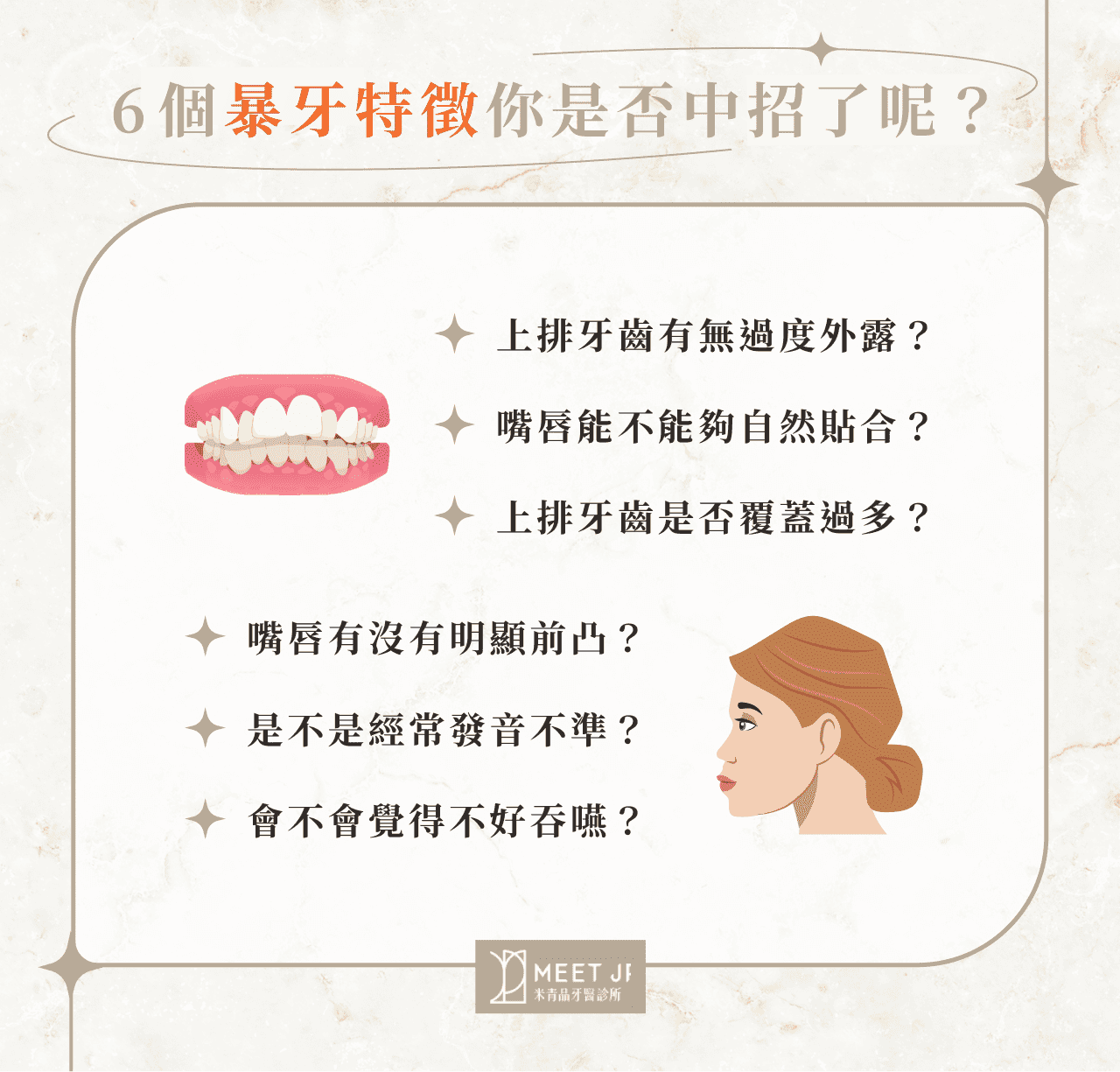 6 個暴牙特徵你是否中招了呢？