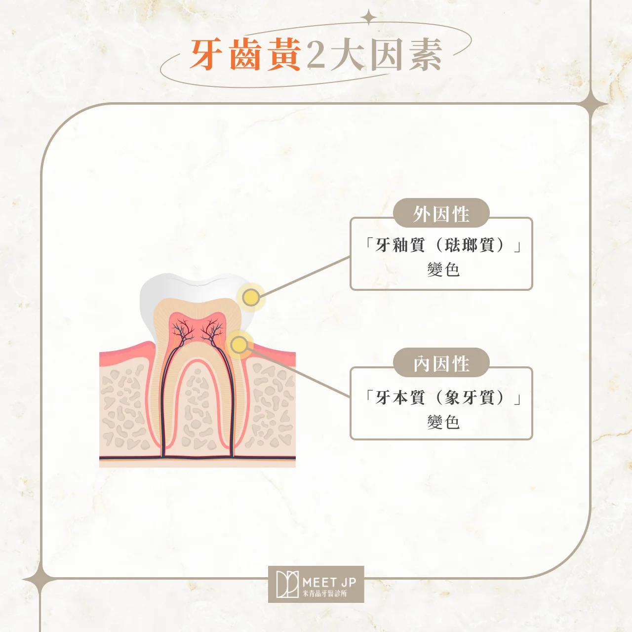 牙齒黃2大因素